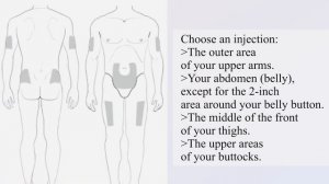 HOW TO INJECT FILGRASTIM (SUBCUTANEOUS) | ItsmeAmy🌸