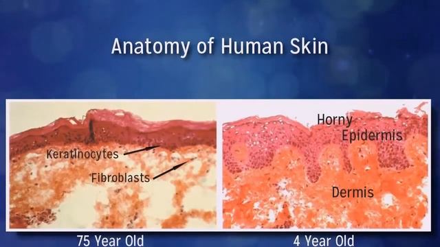 Transfusium Sisel смотреть онлайн