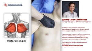 Сухая игла. Pectoralis major. БОЛЬШАЯ ГРУДНАЯ МЫШЦА. Безопасная постановка иглы.
