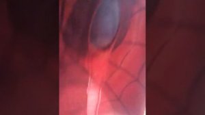 Как стать человеком пауком