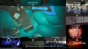 The 11th LION Global Broadcast Tympanoplasty with Ossiculoplasty Franco Trabalzini