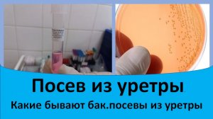 Посевы из уретры. Какие бывают бак посевы.