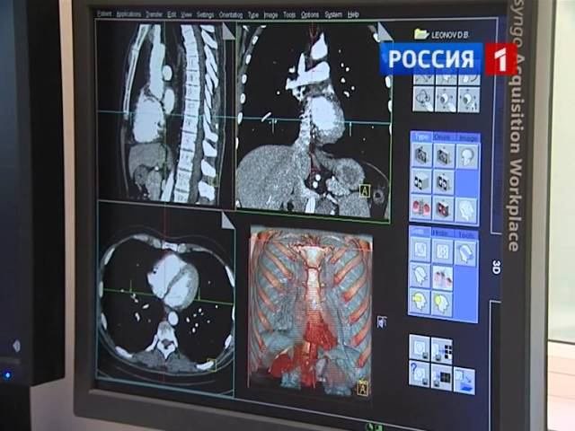Мультиспиральная компьютерная томография. КТ