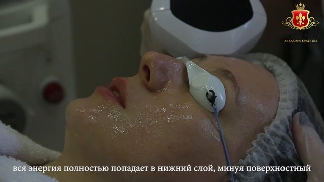 16 Le Grand - Квантовое омоложение лица. Удаление пигментных пятен, купероза. смотреть онлайн