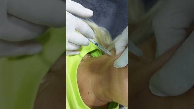 Токсин низ. Практика(фрагмент). смотреть онлайн