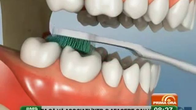 Правильная методика чистки зубов. смотреть онлайн