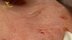 Satisfying Hien Spa Beauty Relaxing Video #27