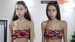 Как сегодня выглядят близняшки Леденевы, у которых вес был 36 кг при росте 177 см