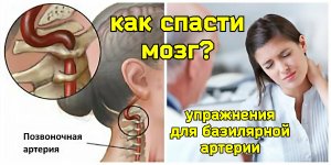 Главный сосуд мозга - базилярная артерия. Почему нужны упражнения для верхней косой мышцы головы?