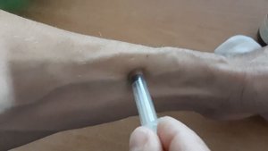 Как вытащить клеща ниткой Если укусил клещ How to Remove a tick with a THREAD Поддубные