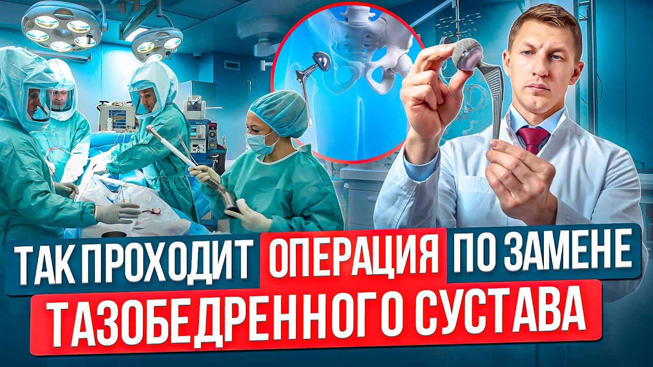 Эндопротезирование тазобедренного сустава. Коксартроз. Как проходит операция по замене сустава тбс.