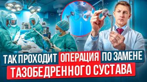 Эндопротезирование тазобедренного сустава. Коксартроз. Как проходит операция по замене сустава тбс.