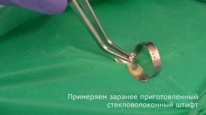 "Восстановление культи зуба под коронку с использованием стекловолоконного штифта"