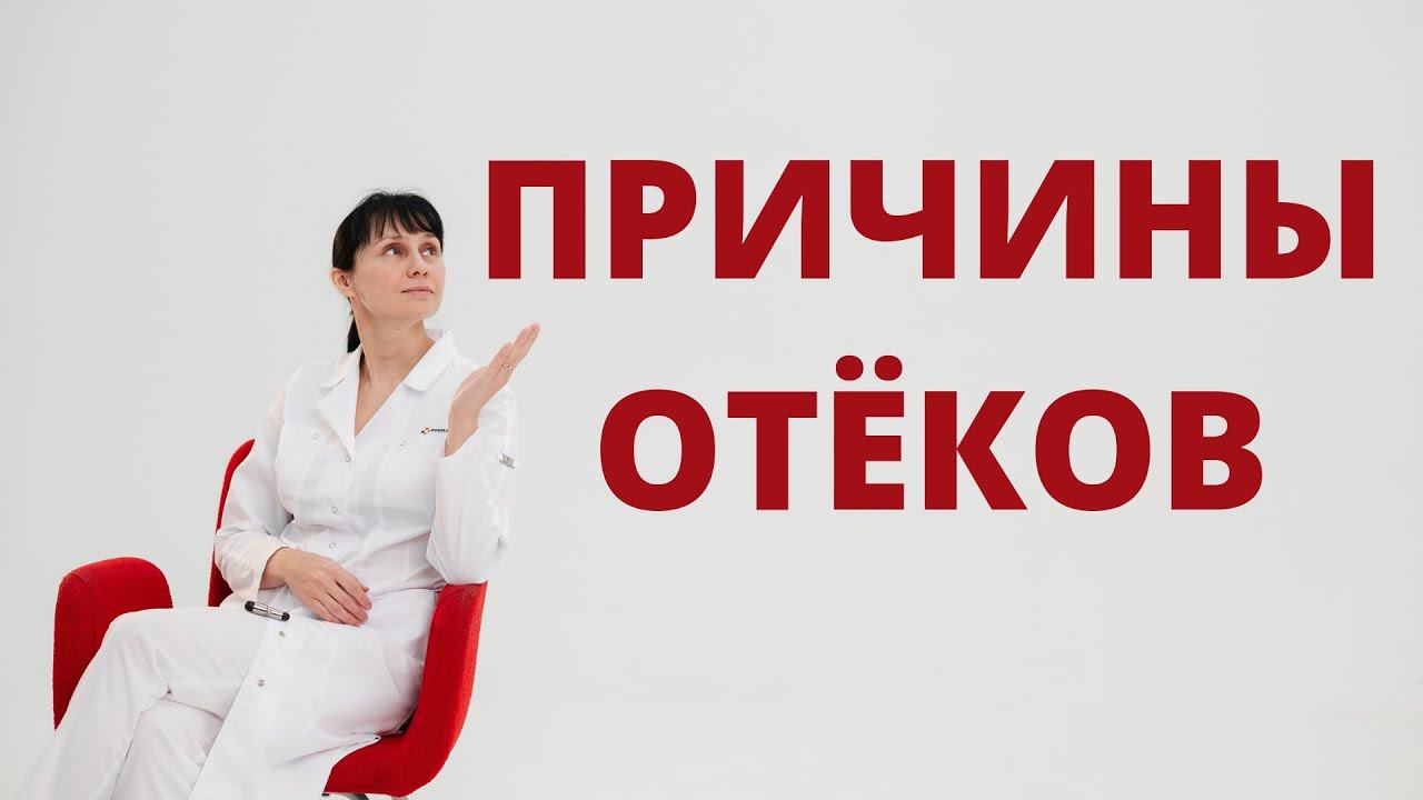 Причины отеков Доктор Лисенкова