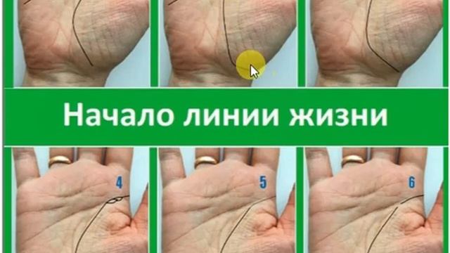 О чём расскажет начало линии Жизни?