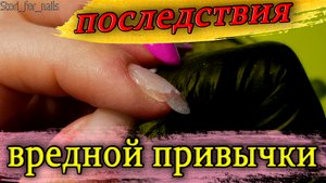 Убираю последствия вредной привычки мастера маникюра обдирание заусенцев на пальцах.mp4