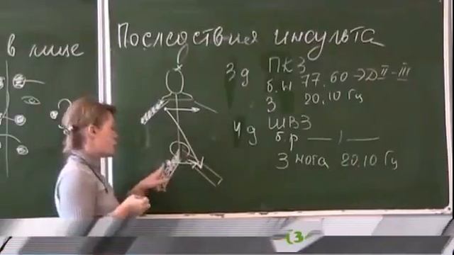 ДЭНАС для восстановлении после инсульта. Школа  ДЭНАС