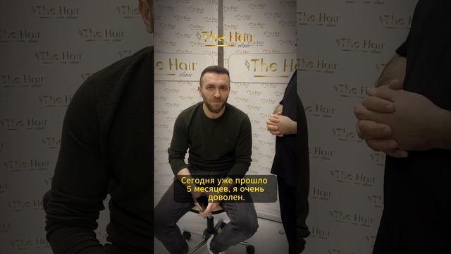 5 месяцев спустя. Пересадка волос 2023. Стамбул / Турция.