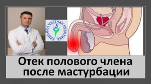 Отек полового члена после мастурбации.