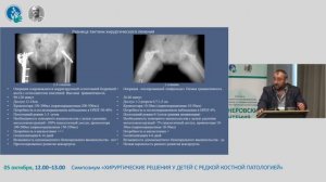 Актуальные вопросы диагностики и лечения юношеского эпифизеолиза головки бедренной кости (ЮЭГБК).
