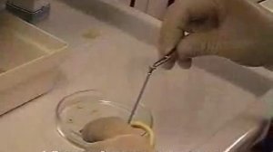 хелпил -- быстрый уреазный тест на хеликобактер