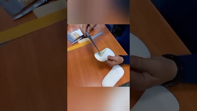 Изготовление или индивидуализация стелек при вальгусе стоп и укорочении ноги на 1 см