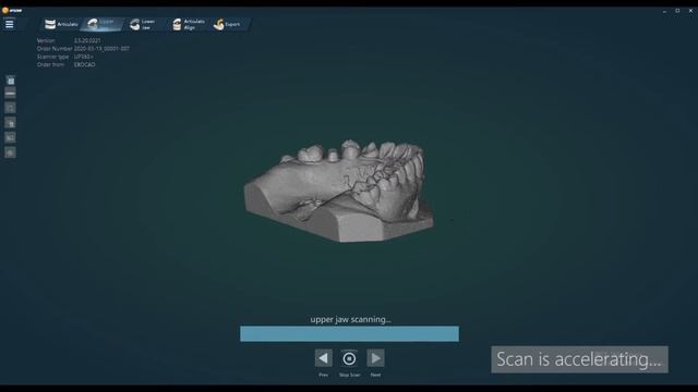 how to scan virtual occlusion with UP300+
