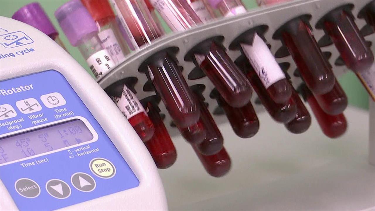 Во всемирный День борьбы со СПИДом в Москве открыт новейший научный центр