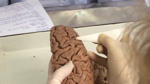 Локализация функций в коре полушарий БМ.