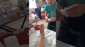 Перевязка после снятия швов ...#красота #образование #весна