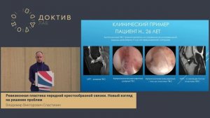 Ревизионная пластика передней крестообразной связки  Новый взгляд на решение проблем