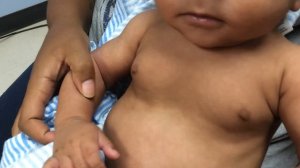 Child with inspiratory stridor