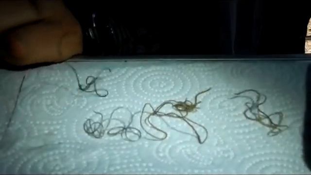 Червь паразит - это нужно видеть каждому! смотреть онлайн