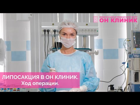 Липосакция в ОН КЛИНИК.