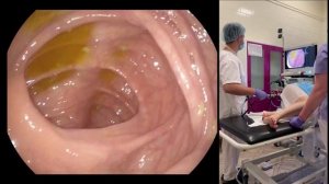 Как делать колоноскопию. Многопрофильная клиника "Скандинавия".How to perform colonoscopy procedur