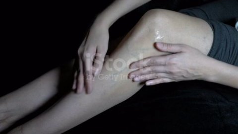 Что такое варикоз и чем он опасен?