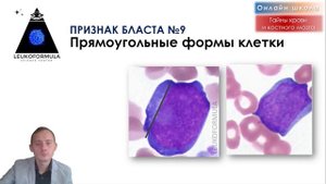 ?Бласты под микроскопом