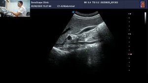 УЗИ органов брюшной полости. Порядок выполнения