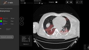 Z-med AI diagnostic module - demo