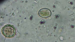 Мед Под Микроскопом: Опыт 2: Х400 Пыльца в Падевом Меде из Турции