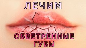 Как лечить обветренные губы? Быстро восстанавливаем кожу губ
