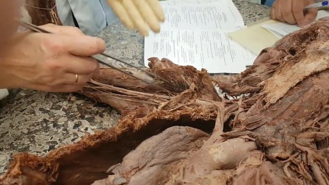 передние ветви грудных нервов и длинные ветви плечевого сплетения -1- смотреть онлайн