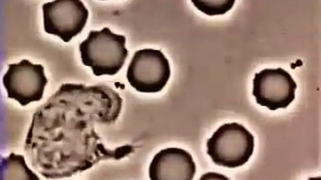 Иммунитет: Лейкоцит преследует и пожирает бактерию золотистого стафилококка