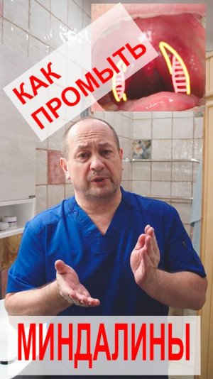 Как промывать миндалины дома? Просто и понятно.  Экономим время и деньги. #доктор #миндалины