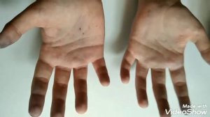 Как отмыть руки от черники