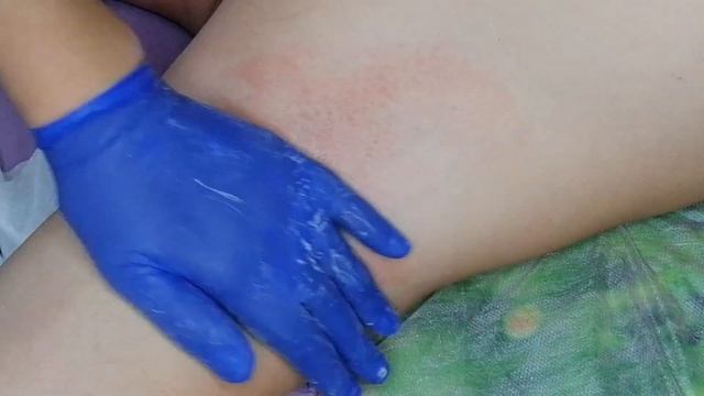 Как удалить сахаром, мужские подмышки, удаление длинных волос, сахарной пастой. смотреть онлайн