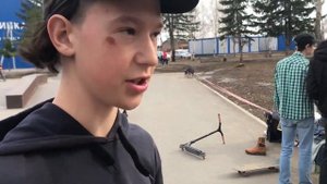 СЛОМАЛ НОГУ НА САМОКАТЕ!