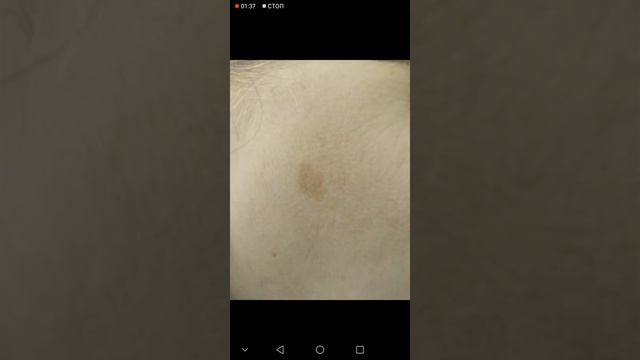 ЧАСТЬ 3.УБИРАЮ ПЕГМЕНТНОЕ ПЯТНО НАТРИЕМ ТИОСУЛЬФАТОМ. ЭКСПЕРИМЕНТ.