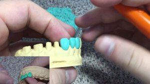 Моделировка зубов. Как моделировать клык. Серия видео моделировки зубов верхней челюсти.