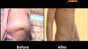 Ти  Би  Джошуа Мальчик исцелился от опухшего живота